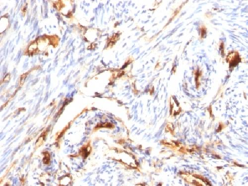Beta-2 Microglobulin (Renal Failure & Tumor Marker) Antibody