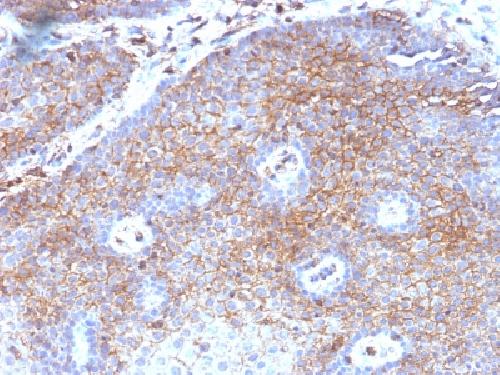 Beta-2 Microglobulin (Renal Failure & Tumor Marker) Antibody