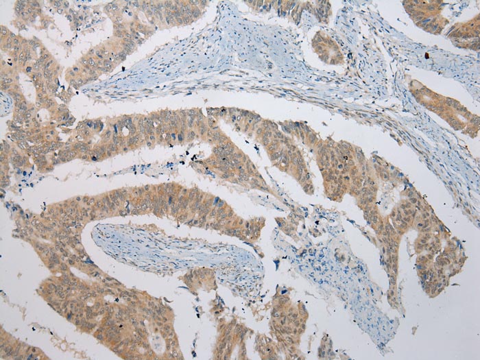 B4GALT5 Antibody