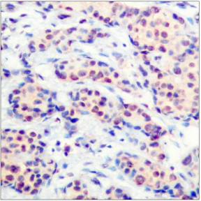 JunD (Ab-255) Antibody