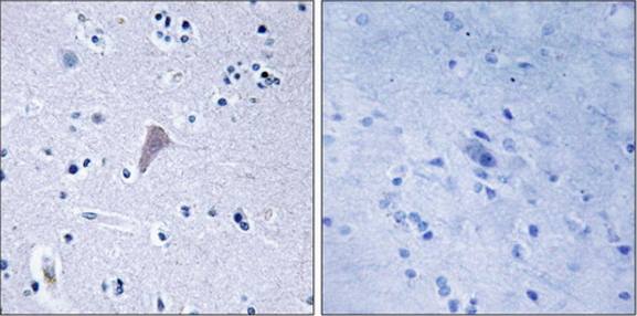 mTOR (Ab-2448) Antibody