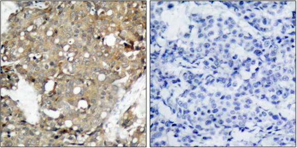 STAT1 (Ab-727) Antibody