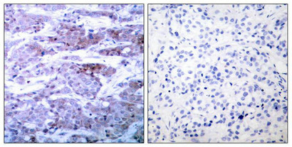 Bad (Ab-112) Antibody