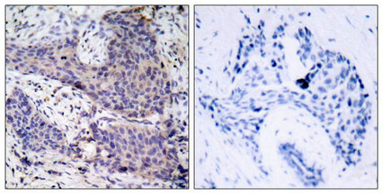 Bad (Ab-136) Antibody