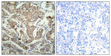 Bad (Ab-155) Antibody