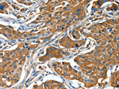 BAG3 Antibody