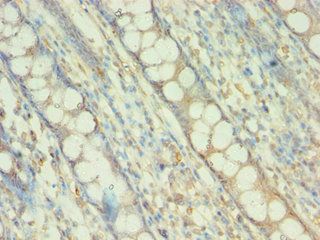 BAG5 Antibody