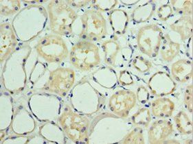 BAG6 Antibody