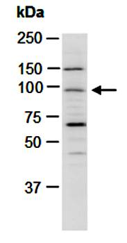 BARD1 (C) Antibody, Rabbit Polyclonal
