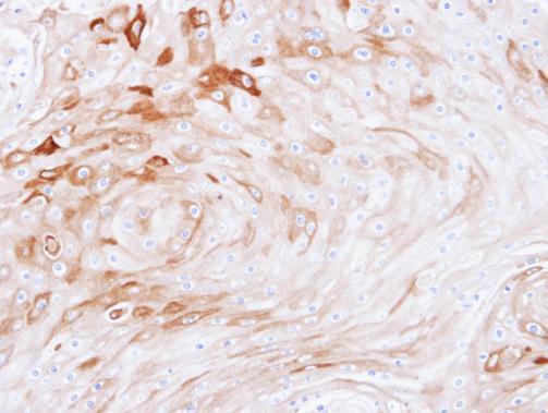 BCAT2 antibody