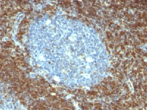 Bcl-2 (Apoptosis & Follicular Lymphoma Marker) Antibody