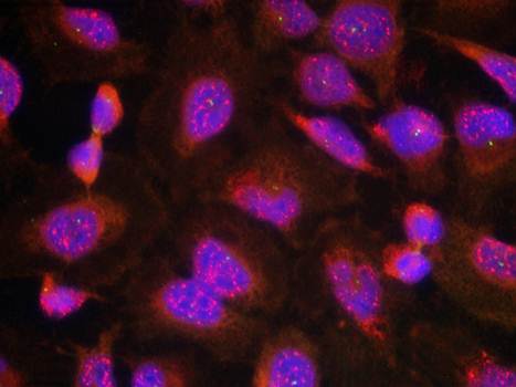 BCL-2 (Ab-70) Antibody