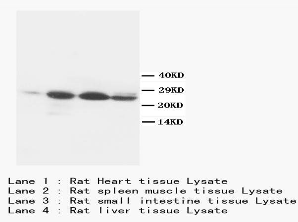 Anti-Bcl-2 Antibody (Monoclonal, Bcl-2-100)
