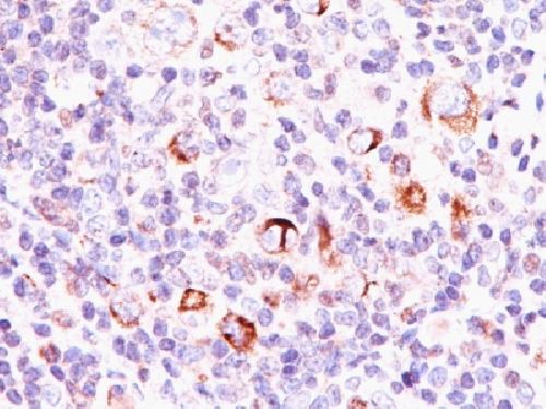 Bcl-X (Apoptosis Marker) Antibody