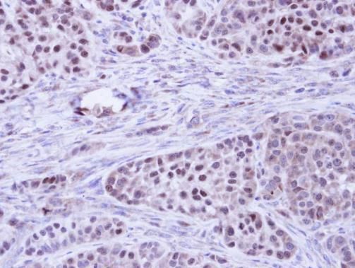 BCL2L10 antibody [N2C2], Internal