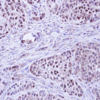 BCL2L10 antibody