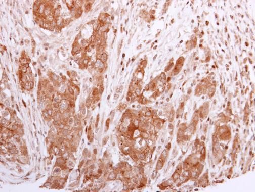BCL2L12 antibody