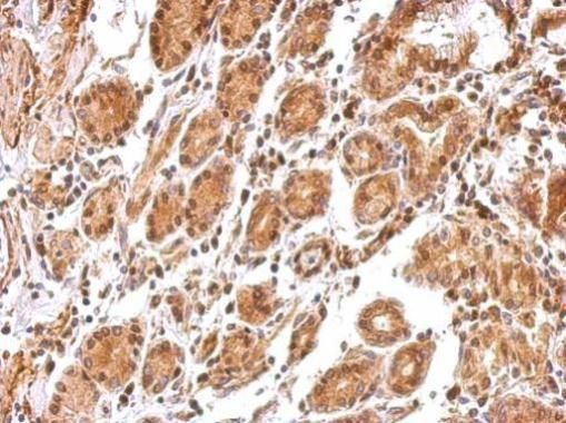 BCL2L12 antibody