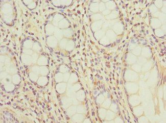 BCL2L15 Antibody