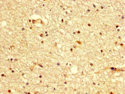 BDKRB2 Antibody