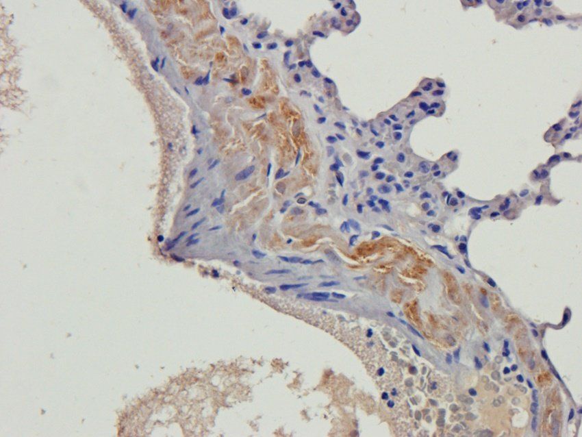 beta 2 Defensin antibody