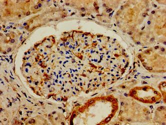 NR1H4 Antibody