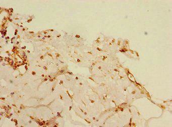 BLID Antibody