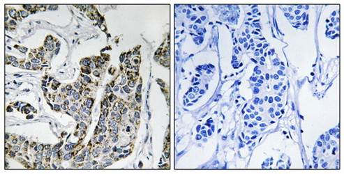 BLK (Phospho-Tyr501) Antibody