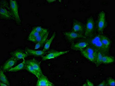 BLNK Antibody