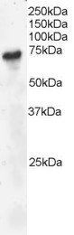 BLNK/SLP-65 Antibody