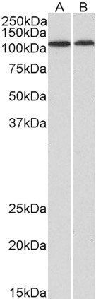 BMP1 (aa284-296) Antibody