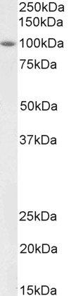 BMP1 (aa284-296) Antibody