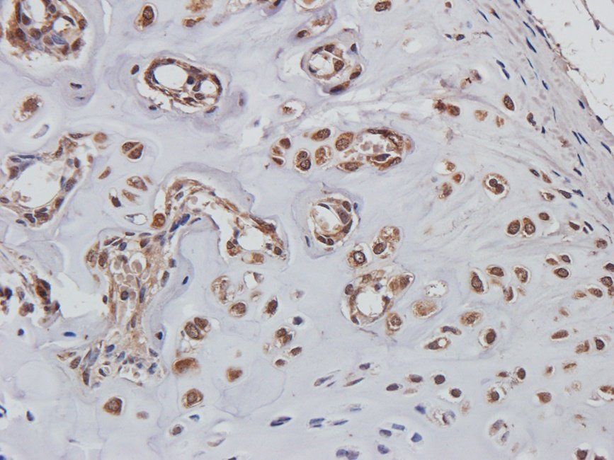 BMP11 antibody