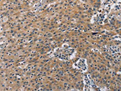 BMP15 Antibody