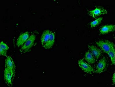 BMPR1B Antibody