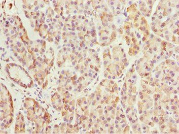 BNIP1 Antibody