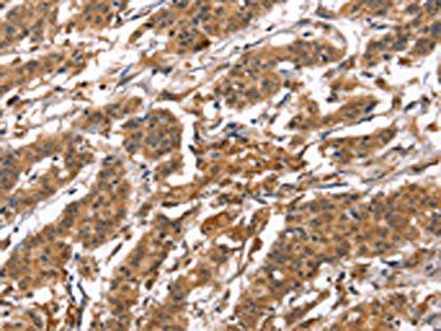 BNIP2 Antibody