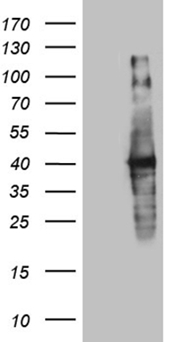 BNP Antibody