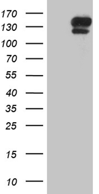 BNP Antibody