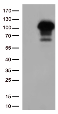 BNP Antibody