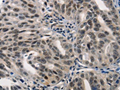 BPIFB1 Antibody