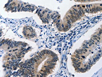 BPIFB1 Antibody