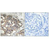 BRAF (Ab-446) Antibody
