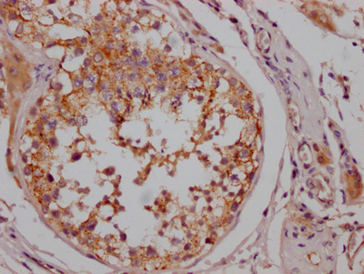 BRAF Recombinant Monoclonal Antibody