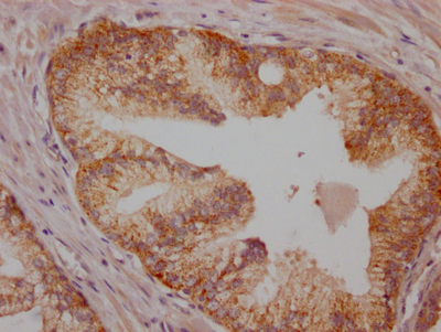 BRAF Recombinant Monoclonal Antibody