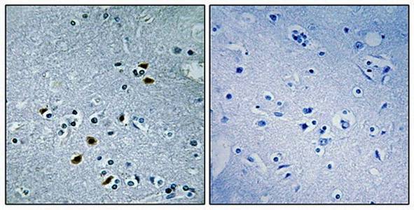 BRCA2 Antibody