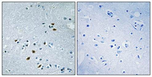 BRCA2 Antibody