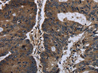 BRINP1 Antibody