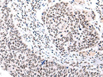 BRMS1 Antibody