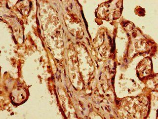 BRSK1 Antibody